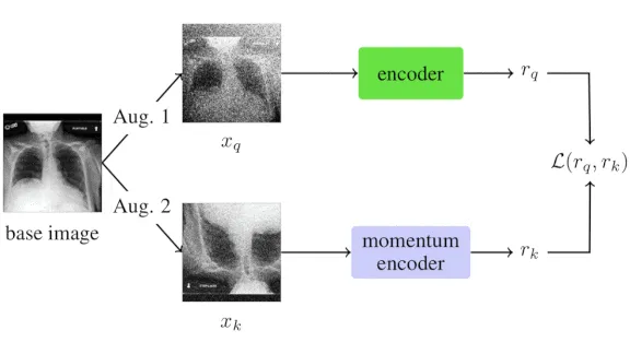 Graph showing system that examines X-ray images to predict which Covid-19 patients are at greatest risk of decline