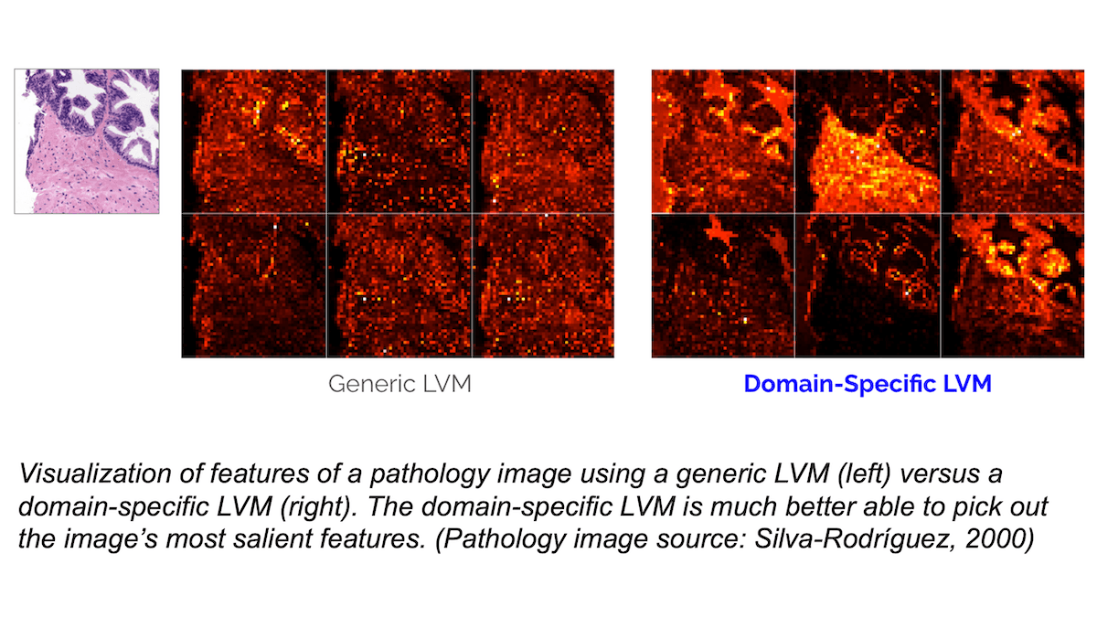 Making Large Vision Models Work for Business: Large language models can learn what they need to know from the internet, but large vision models need training on proprietary data.