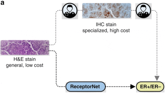 Shortcut to Cancer Treatment: AI suggests breast cancer therapies based on tumor-tissue slides.