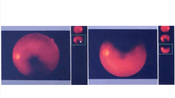 From Proof of Concept to Production