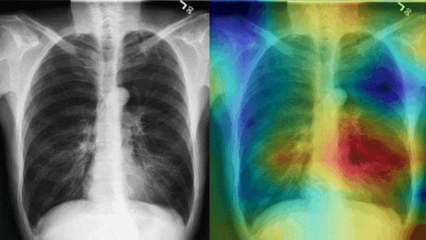Radiologists Eye AI: Radiologists increasingly rely upon computer vision.