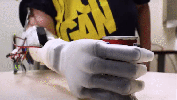 AI Gets a Grip: AI helps amputees control robotic hands.