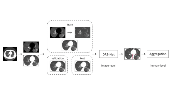 First, Make No Harmful Models: Many AI systems for Covid-19 used biased data.