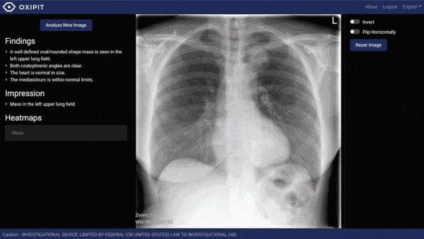 AI Enters the Radiology Department: ChestLink, an AI X-Ray Tool Approved by European Officials
