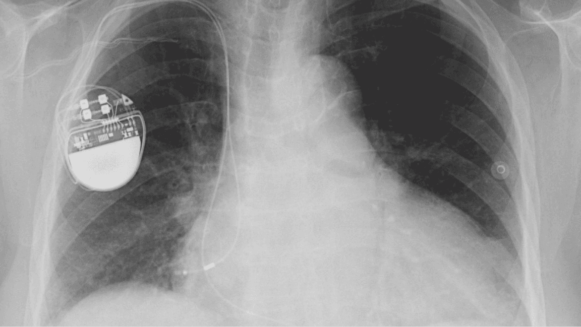 Rules For Medical AI